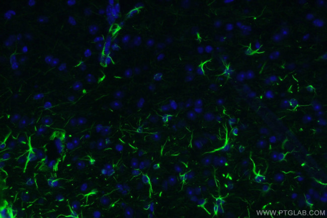 GFAP Antibody in Immunohistochemistry (PFA fixed) (IHC (PFA))