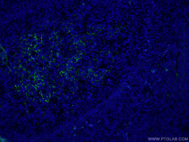 CD23 Antibody in Immunohistochemistry (PFA fixed) (IHC (PFA))