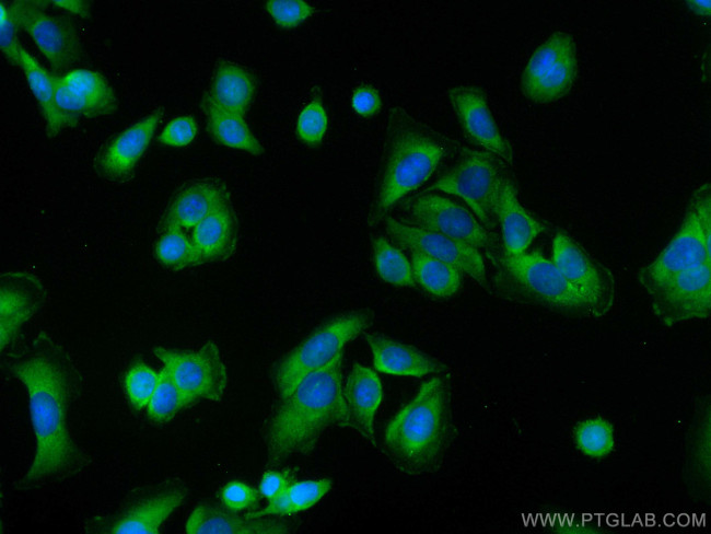 CXCR7 Antibody in Immunocytochemistry (ICC/IF)