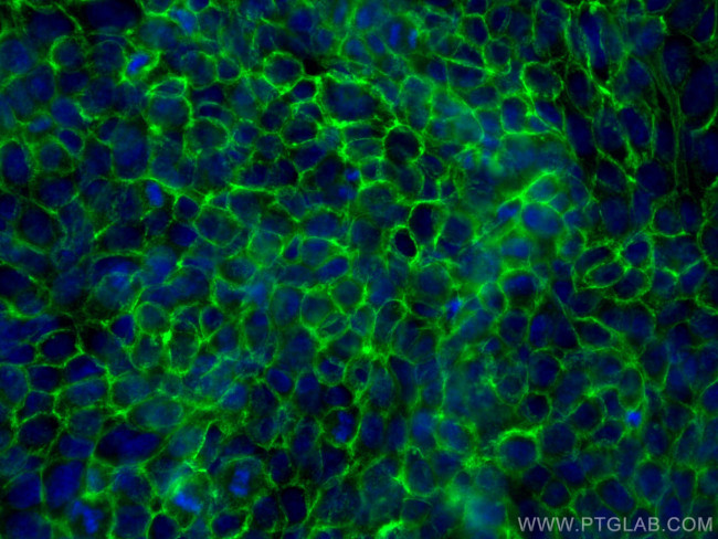 CD44 Antibody in Immunocytochemistry (ICC/IF)