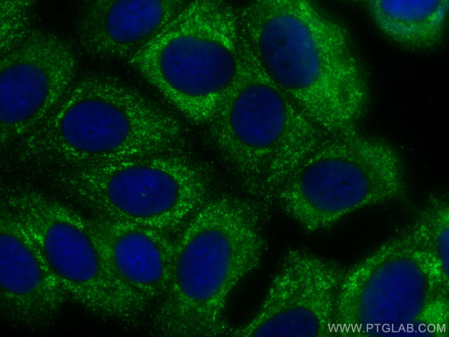 FUT9 Antibody in Immunocytochemistry (ICC/IF)