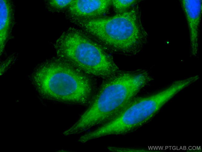 COTL1 Antibody in Immunocytochemistry (ICC/IF)