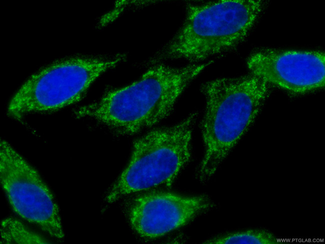SMN-Exon7 Antibody in Immunocytochemistry (ICC/IF)