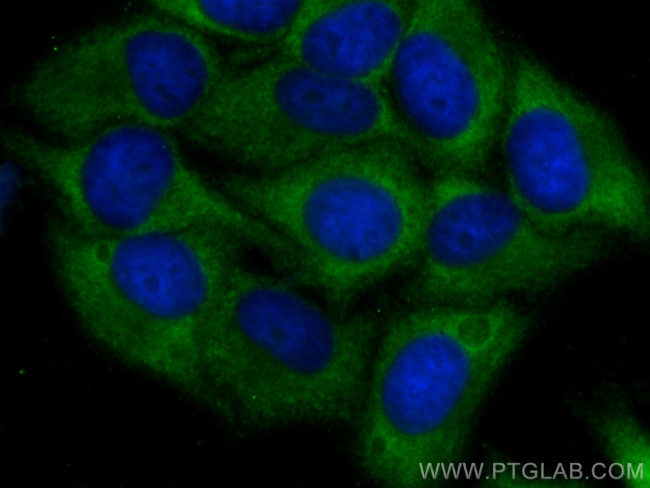 CCT3 Antibody in Immunocytochemistry (ICC/IF)