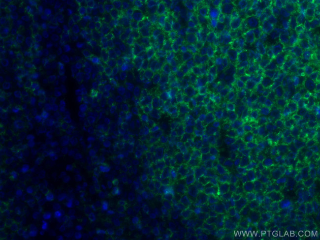 CD20 Antibody in Immunohistochemistry (PFA fixed) (IHC (PFA))