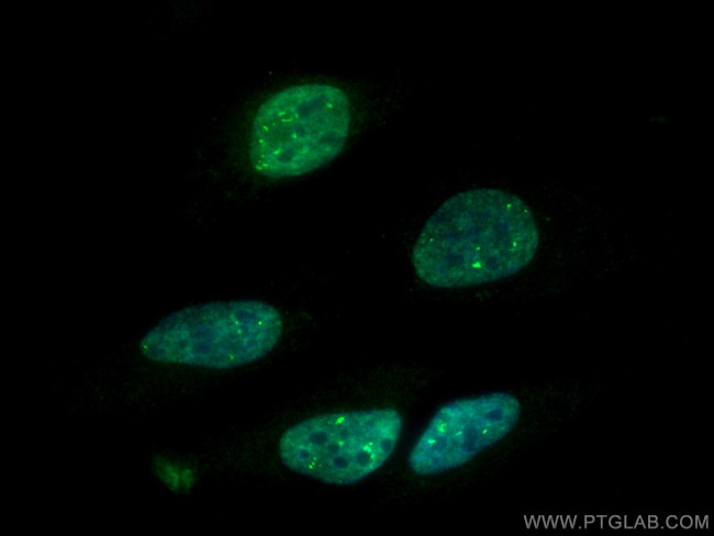 RBM4 Antibody in Immunocytochemistry (ICC/IF)