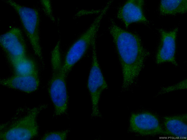 SGTA Antibody in Immunocytochemistry (ICC/IF)