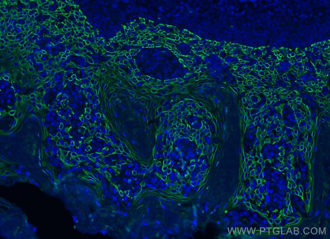 TIM3 Antibody in Immunohistochemistry (Paraffin) (IHC (P))