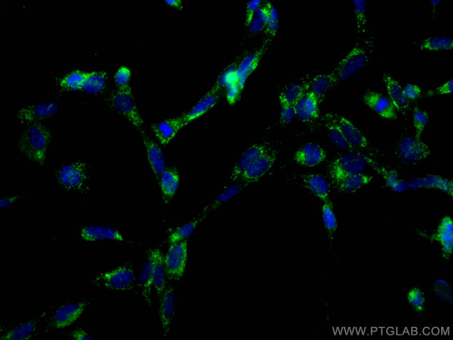CD107a/LAMP1 Antibody in Immunocytochemistry (ICC/IF)