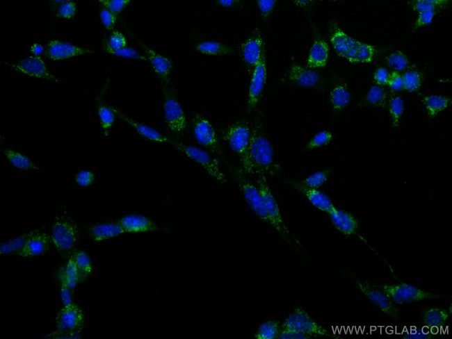CD107b/LAMP2 Antibody in Immunocytochemistry (ICC/IF)