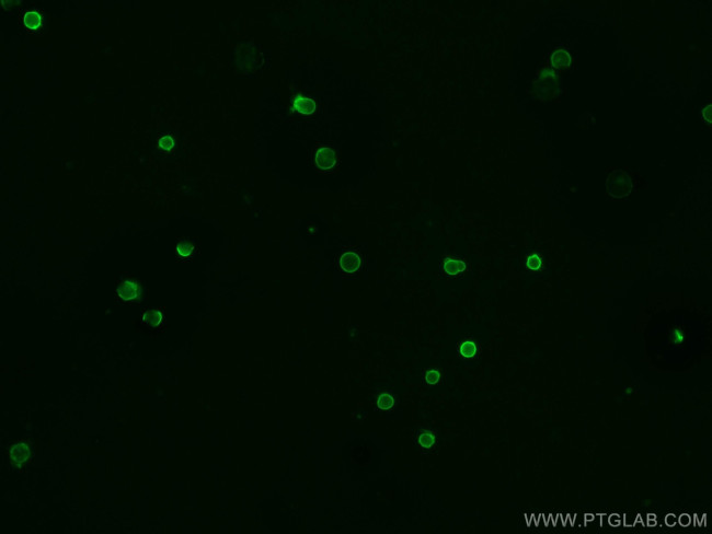 CD45 Antibody in Immunocytochemistry (ICC/IF)