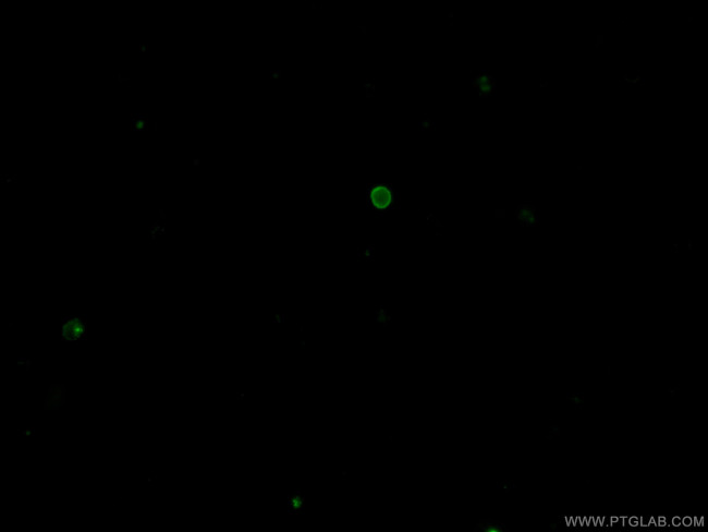 CD4 Antibody in Immunocytochemistry (ICC/IF)