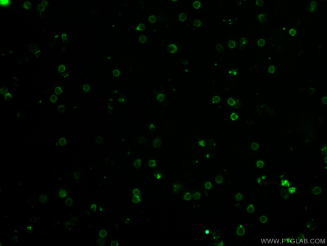 TCR Beta Antibody in Immunocytochemistry (ICC/IF)
