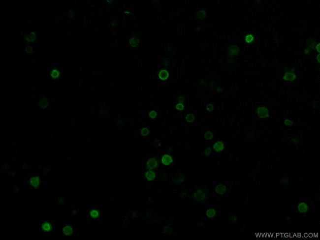 CD38 Antibody in Immunocytochemistry (ICC/IF)