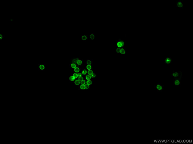 CD11b Antibody in Immunocytochemistry (ICC/IF)