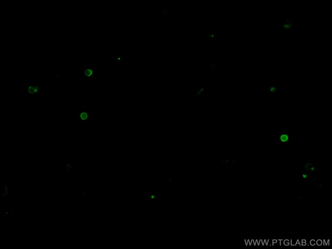 CD11c Antibody in Immunocytochemistry (ICC/IF)