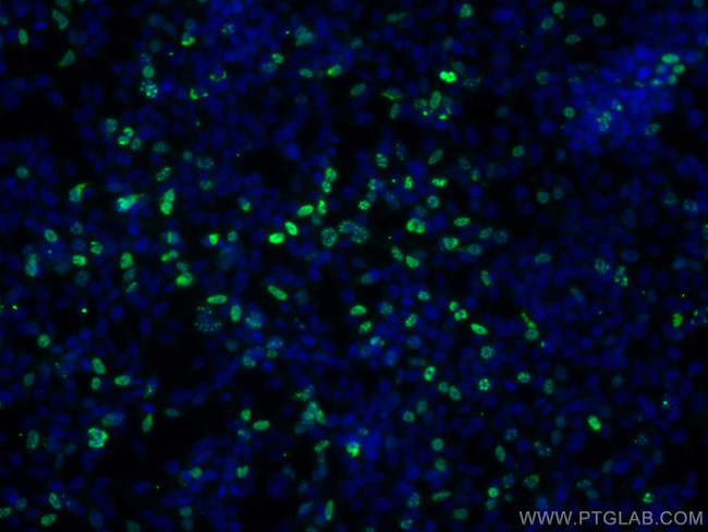 HA Tag Antibody in Immunocytochemistry (ICC/IF)