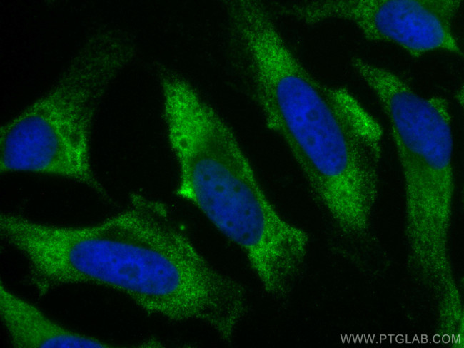 AHCY Antibody in Immunocytochemistry (ICC/IF)