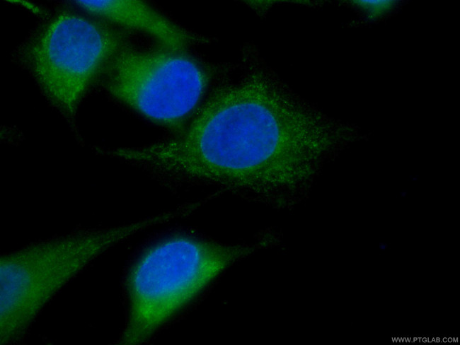 Bcl-XL Antibody in Immunocytochemistry (ICC/IF)