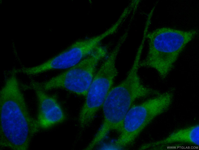 EIF3D Antibody in Immunocytochemistry (ICC/IF)