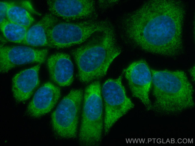 EIF3M Antibody in Immunocytochemistry (ICC/IF)