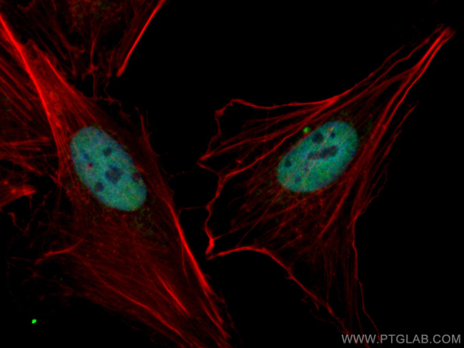 RBAP48 Antibody in Immunocytochemistry (ICC/IF)