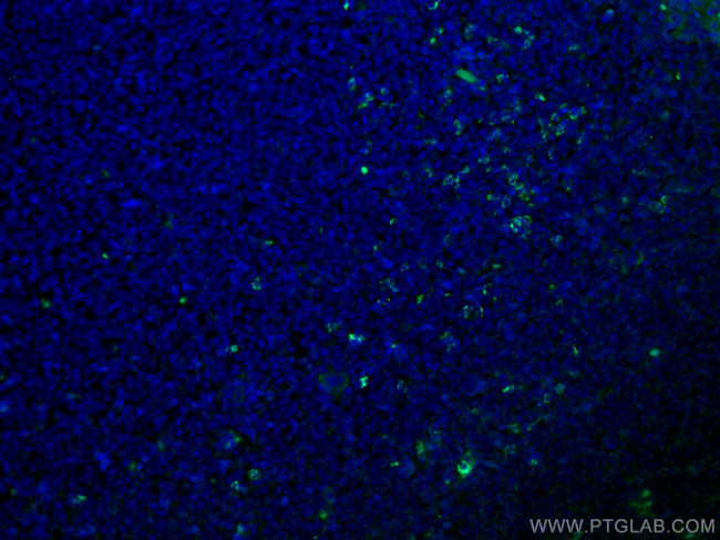 alpha 1 Antichymotrypsin Antibody in Immunohistochemistry (PFA fixed) (IHC (PFA))