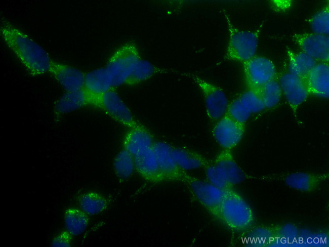 S100A6 Antibody in Immunocytochemistry (ICC/IF)
