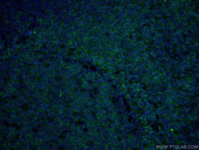 CD22 Antibody in Immunohistochemistry (PFA fixed) (IHC (PFA))