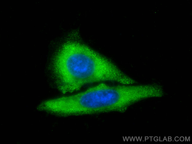 PGM1 Antibody in Immunocytochemistry (ICC/IF)