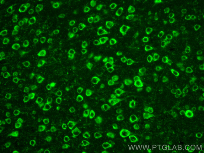 SULT4A1 Antibody in Immunohistochemistry (PFA fixed) (IHC (PFA))