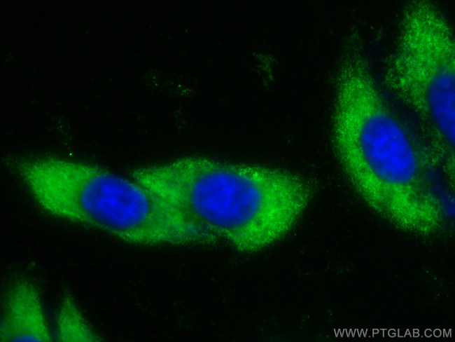 Iduronate 2 sulfatase Antibody in Immunocytochemistry (ICC/IF)