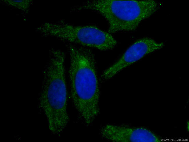 APOL1-Specific Antibody in Immunocytochemistry (ICC/IF)