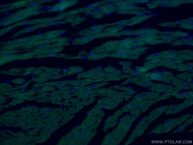 ACTC1-specific Antibody in Immunohistochemistry (PFA fixed) (IHC (PFA))