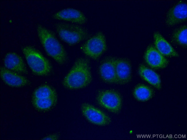 Alpha-2-macroglobulin Antibody in Immunocytochemistry (ICC/IF)