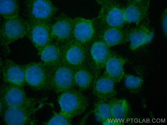 Vitamin D binding protein Antibody in Immunocytochemistry (ICC/IF)
