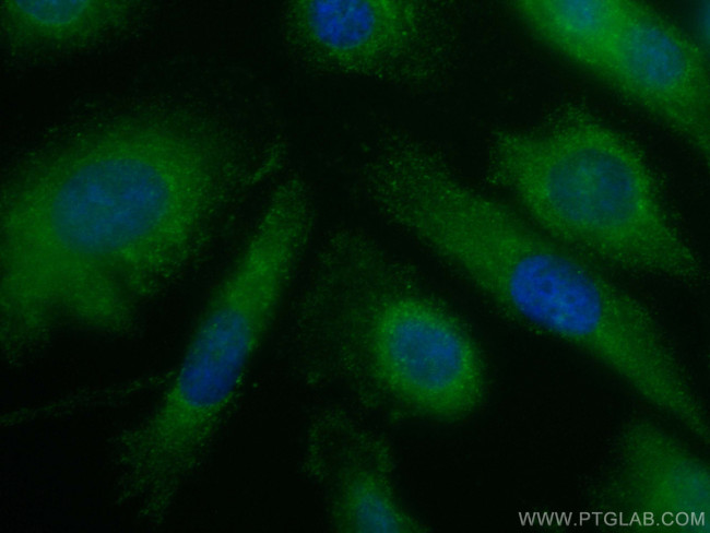 Zinc Alpha 2 Glycoprotein Antibody in Immunocytochemistry (ICC/IF)