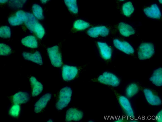 SMARCE1 Antibody in Immunocytochemistry (ICC/IF)
