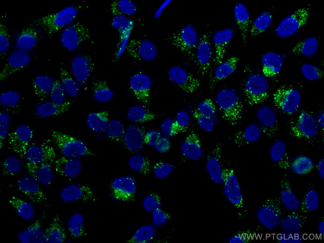 P62/SQSTM1 Antibody in Immunocytochemistry (ICC/IF)