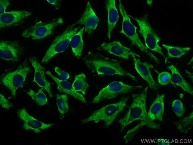 Septin 8 Antibody in Immunocytochemistry (ICC/IF)