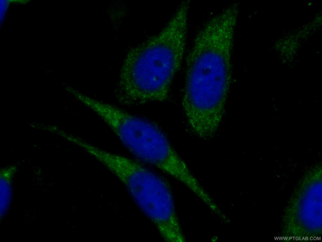 IDH1 Antibody in Immunocytochemistry (ICC/IF)