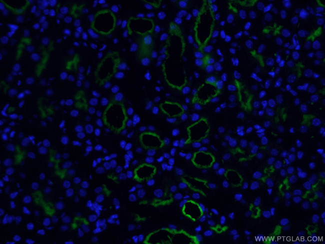 CD13 Antibody in Immunohistochemistry (PFA fixed) (IHC (PFA))