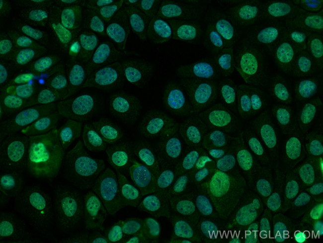 TLE1 Antibody in Immunocytochemistry (ICC/IF)