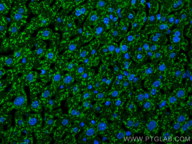 C4 Gamma Chain Antibody in Immunohistochemistry (Paraffin) (IHC (P))