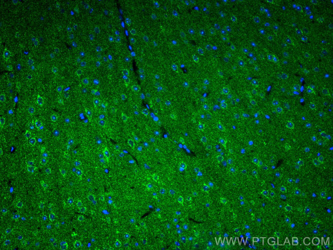 KGA Antibody in Immunohistochemistry (PFA fixed) (IHC (PFA))