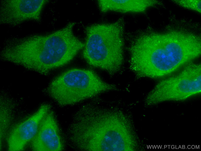 C1qC Antibody in Immunocytochemistry (ICC/IF)