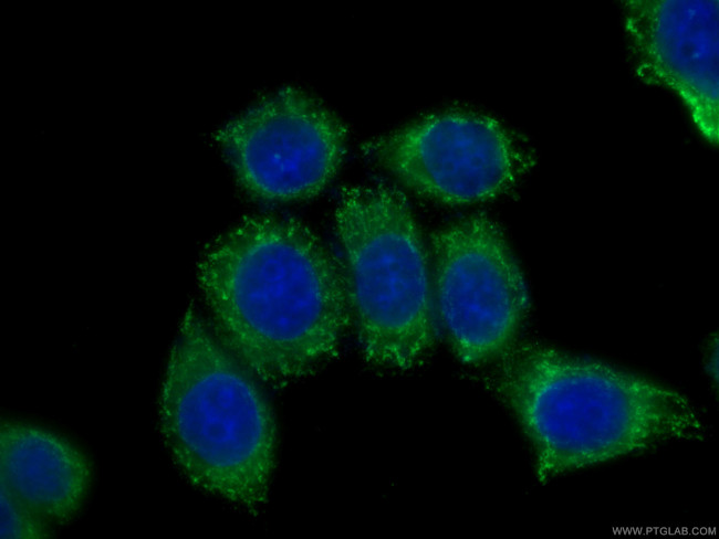 CLTCL1 Antibody in Immunocytochemistry (ICC/IF)