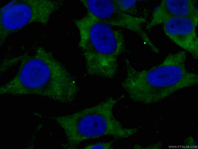 CDK6 Antibody in Immunocytochemistry (ICC/IF)