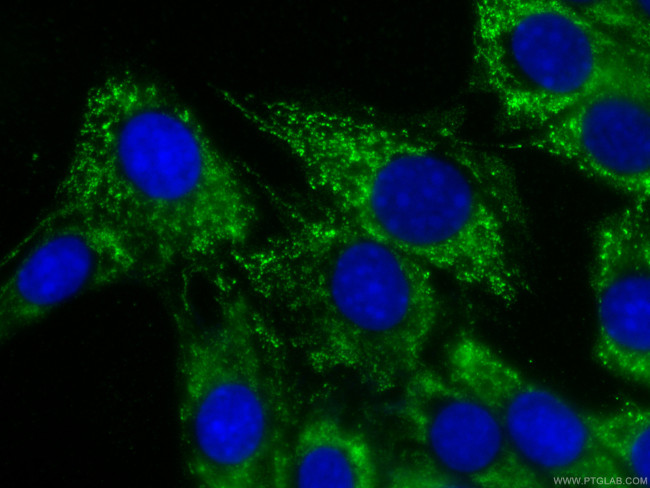 MYL3 Antibody in Immunocytochemistry (ICC/IF)