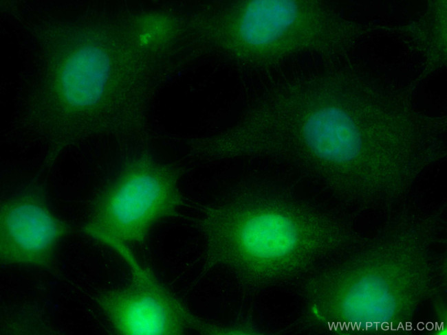 SETDB1 Antibody in Immunocytochemistry (ICC/IF)